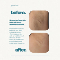 Dr. Fluxon Advance Under Arm Roll-on - 3% AHA & 1% BHA for Brightening & Odor Control (50ml)