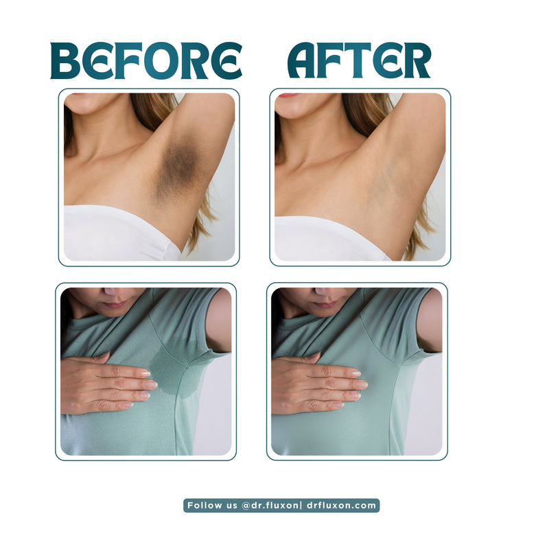 Dr. Fluxon Advance Under Arm Roll-on - 3% AHA & 1% BHA for Brightening & Odor Control (50ml)